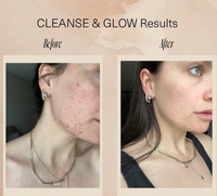 Cleanse & Glow Set by Aloisia Beauty